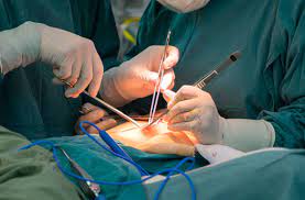 General Surgery